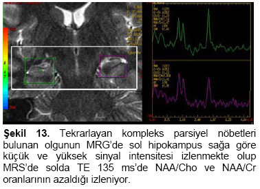 Figure 13